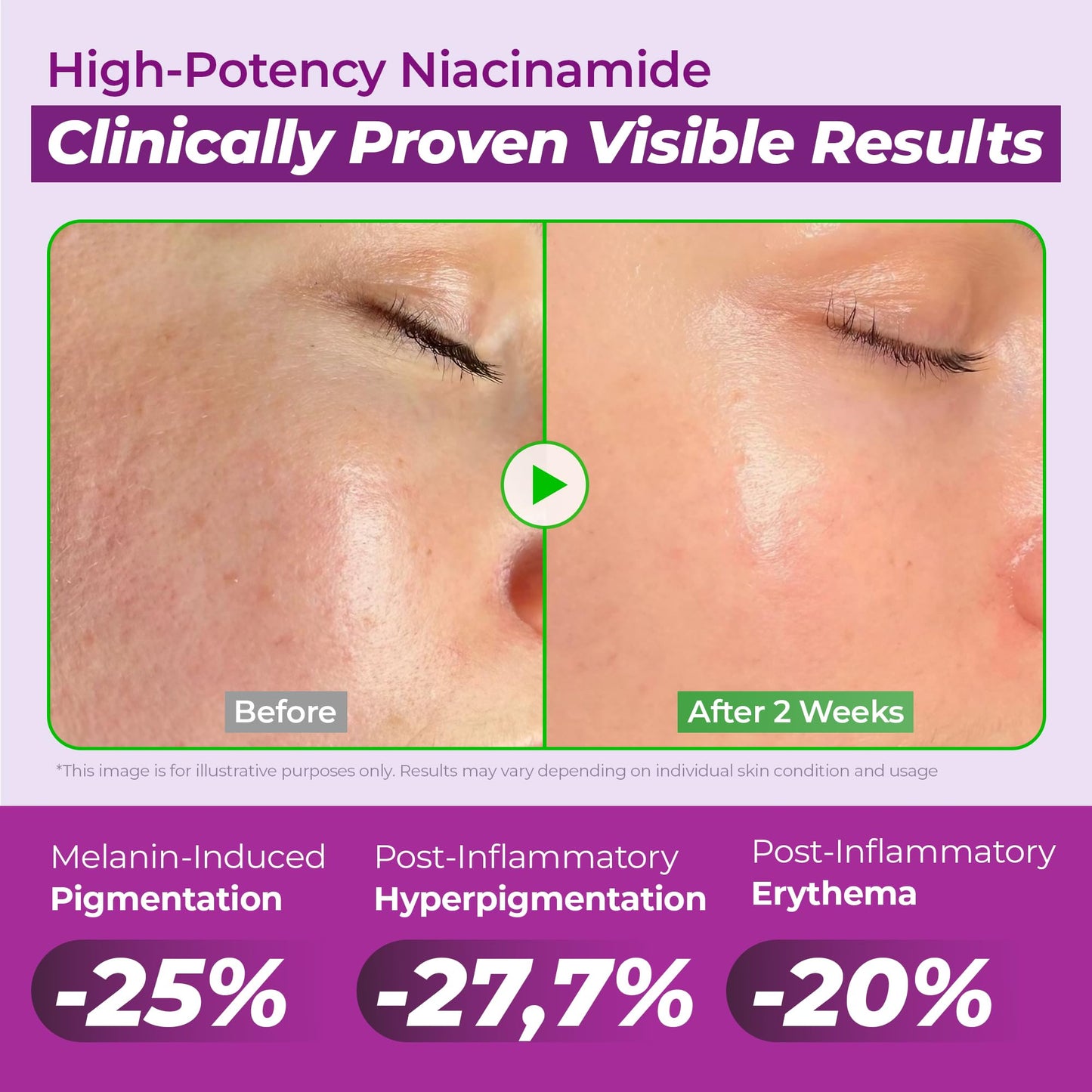 JUMISO Niacinamide 20