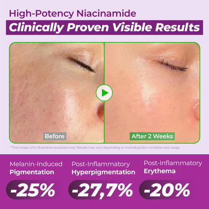 JUMISO Niacinamide 20